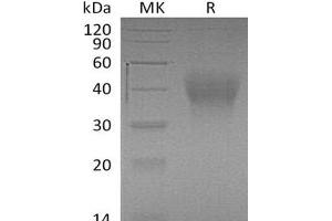 Hepatitis A Virus Cellular Receptor 2 (TIM 3) (AA 20-191) protein (His tag)