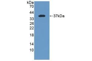 Detection of Recombinant TFR2, Human using Polyclonal Antibody to Transferrin Receptor 2 (TFR2) (Transferrin Receptor 2 anticorps  (AA 493-784))