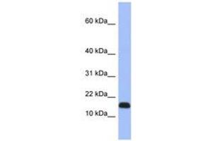 Image no. 1 for anti-Ribosomal Protein L37a (RPL37A) (C-Term) antibody (ABIN6741657) (RPL37A anticorps  (C-Term))