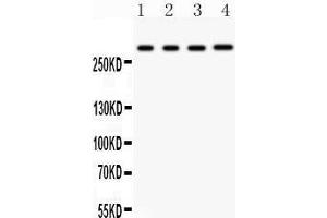 Anti- IP3 receptor antibody, Western blotting All lanes: Anti IP3 receptor  at 0. (ITPR1 anticorps  (AA 2411-2758))