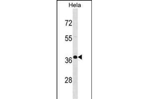 BPN1 Antibody (C-term) (ABIN1536983 and ABIN2848520) western blot analysis in Hela cell line lysates (35 μg/lane). (PABPN1 anticorps  (C-Term))