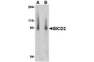 Western blot analysis of BICD2 in A549 cell lysate with AP30146PU-N BICD2 antibody at (A) 1 and (B) 2 μg/ml. (BICD2 anticorps  (Center))