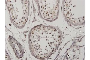 Immunoperoxidase of monoclonal antibody to IRF5 on formalin-fixed paraffin-embedded human testis.