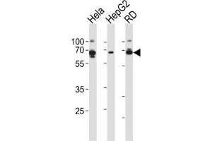 Western Blotting (WB) image for anti-Protein Kinase, AMP-Activated, gamma 3 Non-Catalytic Subunit (PRKAG3) antibody (ABIN2999063) (PRKAG3 anticorps)