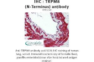 Image no. 1 for anti-Transient Receptor Potential Cation Channel, Subfamily M, Member 8 (TRPM8) (Cytoplasmic Domain), (N-Term) antibody (ABIN1740398)