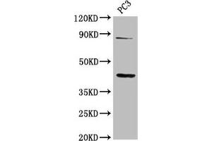 Western Blot Positive WB detected in: PC-3 whole cell lysate All lanes: TNFRSF19 antibody at 2. (TNFRSF19 anticorps  (AA 276-415))