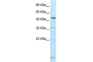 DMRTA2 antibody used at 0. (DMRTA2 anticorps  (C-Term))