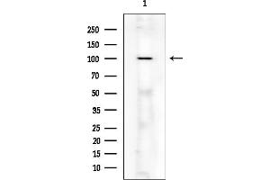anti-Ubiquitin Specific Peptidase 28 (USP28) (N-Term) antibody