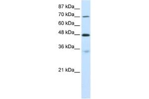 Western Blotting (WB) image for anti-Cysteinyl-tRNA Synthetase (CARS) antibody (ABIN2462085) (CARS anticorps)