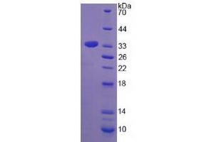 Image no. 1 for Tryptase beta 2 (TPSB2) (AA 30-274) protein (His tag) (ABIN4990021) (TPSB2 Protein (AA 30-274) (His tag))