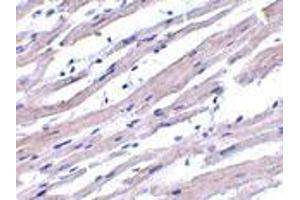 Immunohistochemistry of Apaf1 in human heart tissue with Apaf1 antibody at 1 μg/ml.