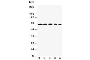 Western blot testing of RelB antibody and Lane 1:  rat testis (RELB anticorps  (AA 393-413))