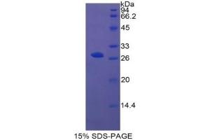 SDS-PAGE of Protein Standard from the Kit (Highly purified E. (ITGA2 Kit ELISA)