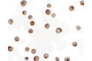 Immunocytochemistry of RILP in HeLa cells with RILP antibody at 2.