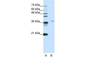 WB Suggested Anti-SART3 Antibody Titration:  2. (SART3 anticorps  (N-Term))