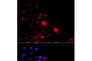 Immunofluorescence analysis of U2OS cells using DDB2 Polyclonal Antibody (DDB2 anticorps)