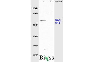 L1 rat brain, L2 rat colon lysates probed (ABIN725855) at 1:200 in 4 °C. (Estrogen Receptor alpha + beta (AA 201-300) anticorps)