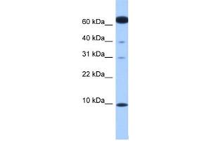 WB Suggested Anti-DYNLL2 Antibody Titration: 0. (DYNLL2 anticorps  (N-Term))