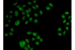 Immunofluorescence analysis of HeLa cells using OAS1 antibody (ABIN5971361). (OAS1 anticorps)