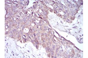 Fig. (PKHD1 anticorps  (AA 3878-4060))