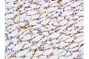 Formalin-fixed and paraffin embedded rat kidney tissue labeled with Anti-STAT2 Polyclonal Antibody, Unconjugated  at 1:200 followed by conjugation to the secondary antibody, (SP-0023), and DAB staining