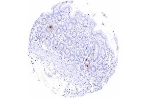 Duodenum mucosa Intense somatostatin staining of scattered neuroendocrine delta cells (Recombinant Somatostatin anticorps)