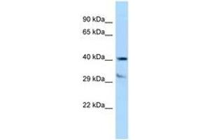 Image no. 1 for anti-Tocopherol (Alpha) Transfer Protein (TTPA) (AA 204-253) antibody (ABIN6747970) (TTPA anticorps  (AA 204-253))