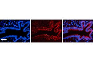 KARS antibody - C-terminal region          Formalin Fixed Paraffin Embedded Tissue:  Human Bronchial Epithelial Tissue    Observed Staining:  Cytoplasm of bronchial epithelial tissue   Primary Antibody Concentration:  1:100    Secondary Antibody:  Donkey anti-Rabbit-Cy3    Secondary Antibody Concentration:  1:200    Magnification:  20X    Exposure Time:  0. (KARS anticorps  (C-Term))