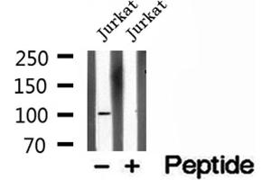 Western blot analysis of extracts of Jurkat cells, using OTUD7B antibody.