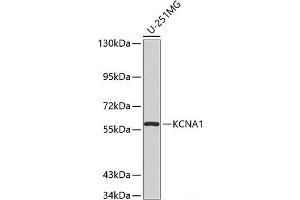 Western blot analysis of extracts of U-251MG cells using KCNA1 Polyclonal Antibody. (KCNA1 anticorps)