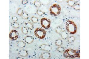 IHC-P analysis of kidney tissue, with DAB staining. (KRT17 anticorps  (AA 252-393))