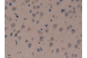 Detection of DKK3 in Mouse Brain Tissue using Polyclonal Antibody to Dickkopf Related Protein 3 (DKK3)