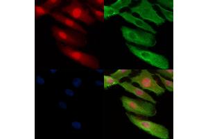 Phospho-TMS1/ASC (Ser195) Antibody staining A549 cells(H2O2 treatment) by IF/ICC. (PYCARD anticorps  (pSer195))