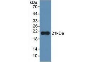 Detection of Recombinant IL1a, Human using Monoclonal Antibody to Interleukin 1 Alpha (IL1a)