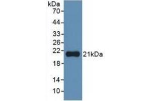 Detection of Recombinant IL1a, Human using Monoclonal Antibody to Interleukin 1 Alpha (IL1a) (IL1A anticorps  (AA 113-271))