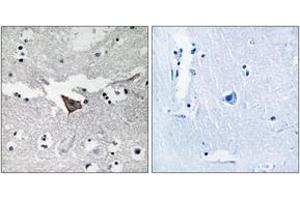 Immunohistochemistry analysis of paraffin-embedded human brain tissue, using FAK (Ab-925) Antibody. (FAK anticorps  (AA 892-941))