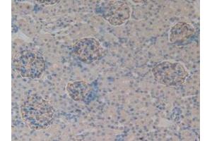 IHC-P analysis of Rat Kidney Tissue, with DAB staining. (PODXL anticorps  (AA 153-386))