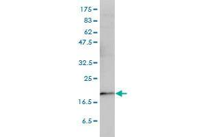 TEBP monoclonal antibody (M01), clone 3H1-2A8 Western Blot analysis of TEBP expression in HeLa .