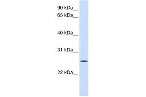 UNC50 antibody used at 1 ug/ml to detect target protein. (UNC50 anticorps)
