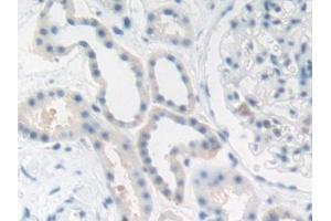 Detection of CEA in Human Kidney Tissue using Polyclonal Antibody to Carcinoembryonic Antigen (CEA)