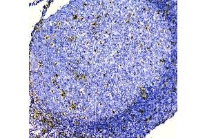 IHC analysis of ZEB2 using anti-ZEB2 antibody (ABIN3042325). (ZEB2 anticorps  (AA 1-200))