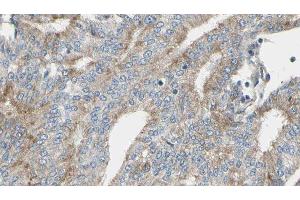 ABIN6276905 at 1/100 staining Human prostate tissue by IHC-P. (IL2RG anticorps  (N-Term))