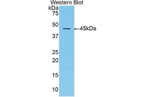 Detection of Recombinant a1AT, Mouse using Polyclonal Antibody to Alpha-1-Antitrypsin (a1AT)