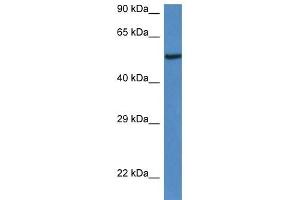 Western Blot showing 9030625A04Rik antibody used at a concentration of 1. (LACC1 anticorps  (C-Term))