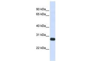 Image no. 1 for anti-serine Peptidase Inhibitor, Kunitz Type, 2 (SPINT2) (AA 180-229) antibody (ABIN6741061) (SPINT2 anticorps  (AA 180-229))