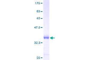 Image no. 1 for BRICK1, SCAR/WAVE Actin-Nucleating Complex Subunit (BRK1) (AA 1-75) protein (GST tag) (ABIN1347505)