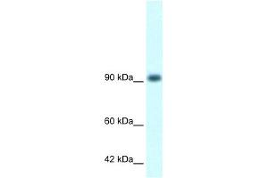 WB Suggested Anti-RBM10 Antibody Titration:  1. (RBM10 anticorps  (N-Term))