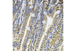 Immunohistochemistry of paraffin-embedded mouse intestine using NFU1 Antibody (ABIN5975479) at dilution of 1/100 (40x lens). (NFU1 anticorps)