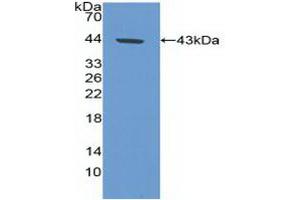 Western blot analysis of recombinant Human CA9. (CA9 anticorps  (AA 59-414))