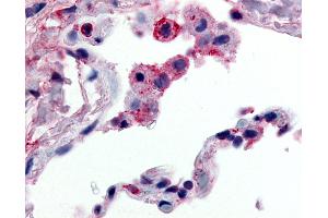 Anti-GPR43 antibody IHC of human lung, alveolar macrophages. (FFAR2 anticorps  (C-Term))